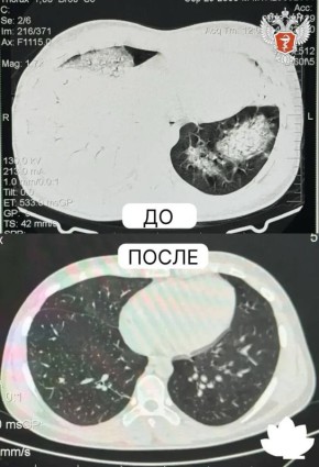 ������������ ����� ������ �������� � ��������� ���������� ������