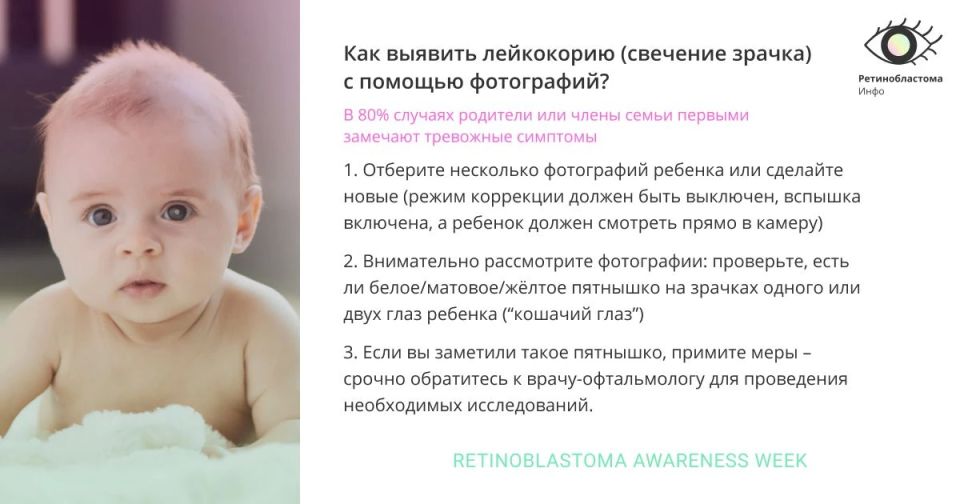 Ретинобластома: что важно знать родителям? Ретинобластома: что важно знать родителям?